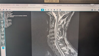 AEW/ROH Star Reveals Herniated Disc Affecting Spinal Cord